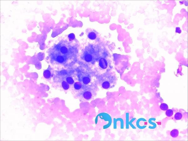 Cristal hepatocito.jpg Cristal hepatocito.jpg